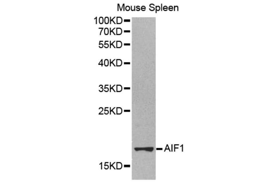 Western blot - AIF1 antibody from Signalway Antibody (38248) - Antibodies.com