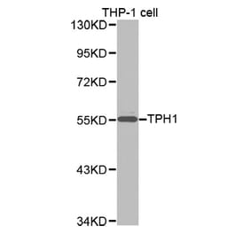 Western blot - TPH1 antibody from Signalway Antibody (38257) - Antibodies.com