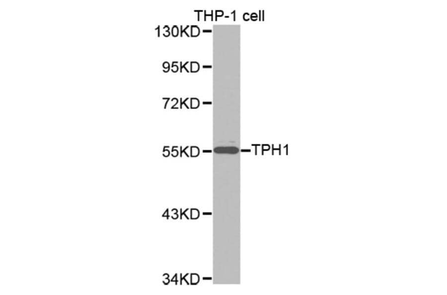 Western blot - TPH1 antibody from Signalway Antibody (38257) - Antibodies.com