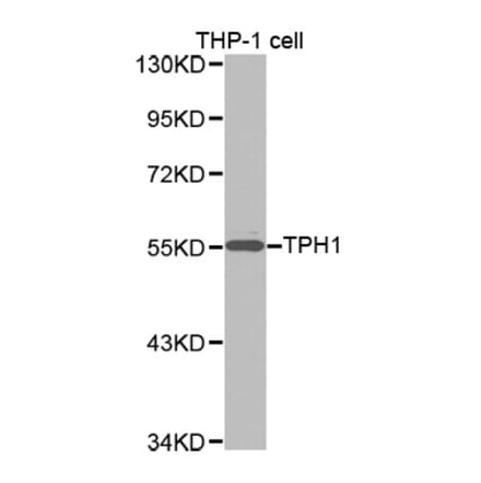 Western blot - TPH1 antibody from Signalway Antibody (38257) - Antibodies.com