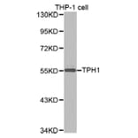 Western blot - TPH1 antibody from Signalway Antibody (38257) - Antibodies.com