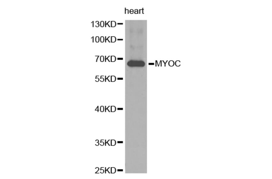 Western blot - MYOC antibody from Signalway Antibody (38261) - Antibodies.com