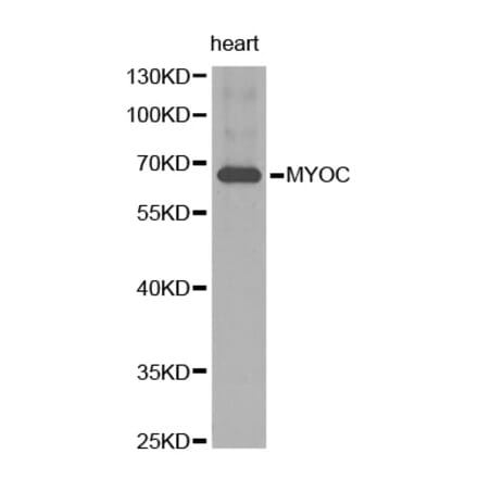 Western blot - MYOC antibody from Signalway Antibody (38261) - Antibodies.com