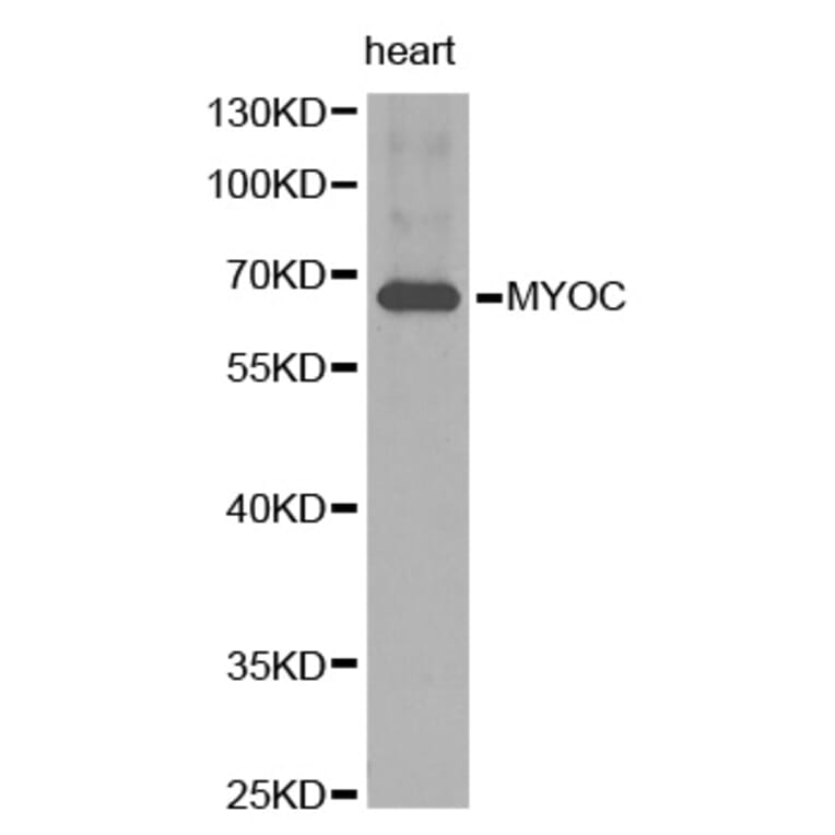 Western blot - MYOC antibody from Signalway Antibody (38261) - Antibodies.com