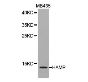 Western blot - HAMP antibody from Signalway Antibody (38265) - Antibodies.com