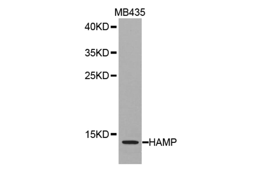 Western blot - HAMP antibody from Signalway Antibody (38265) - Antibodies.com