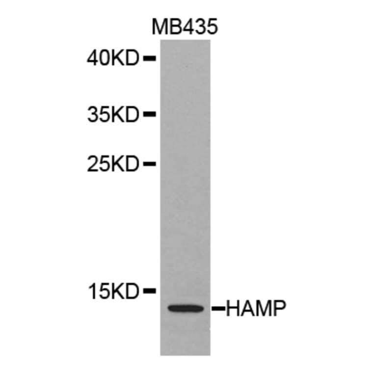 Western blot - HAMP antibody from Signalway Antibody (38265) - Antibodies.com