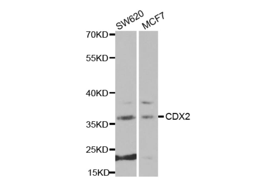 Western blot - CDX2 antibody from Signalway Antibody (38270) - Antibodies.com