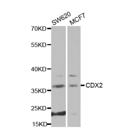 Western blot - CDX2 antibody from Signalway Antibody (38270) - Antibodies.com