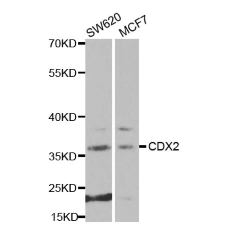 Western blot - CDX2 antibody from Signalway Antibody (38270) - Antibodies.com
