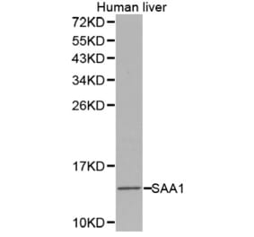 Western blot - SAA1 antibody from Signalway Antibody (38275) - Antibodies.com