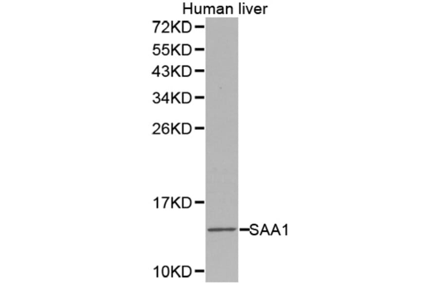 Western blot - SAA1 antibody from Signalway Antibody (38275) - Antibodies.com