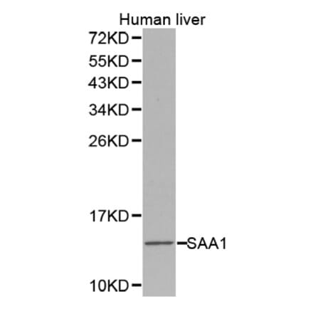 Western blot - SAA1 antibody from Signalway Antibody (38275) - Antibodies.com