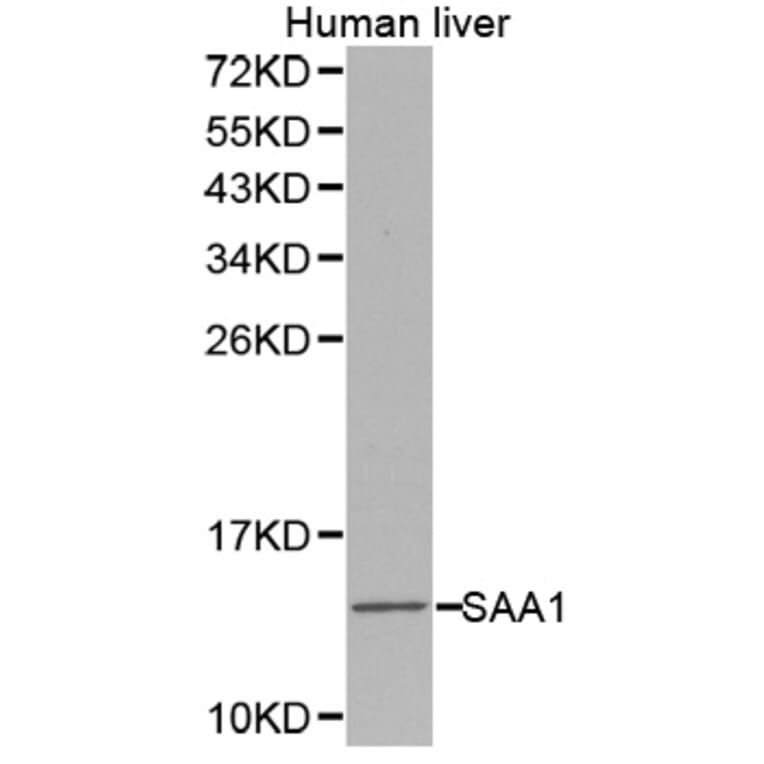 Western blot - SAA1 antibody from Signalway Antibody (38275) - Antibodies.com