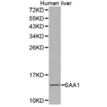 Western blot - SAA1 antibody from Signalway Antibody (38275) - Antibodies.com