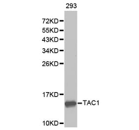 Western blot - TAC1 antibody from Signalway Antibody (38276) - Antibodies.com