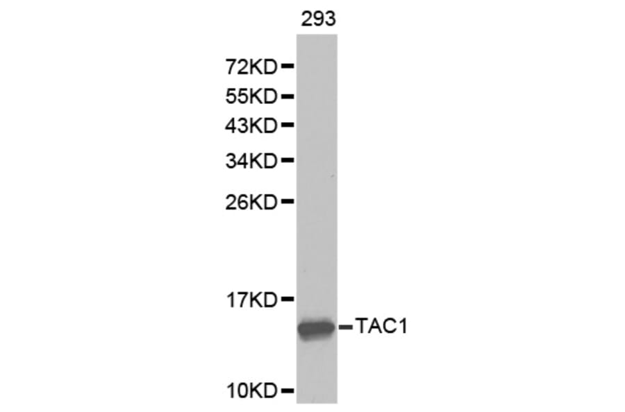 Western blot - TAC1 antibody from Signalway Antibody (38276) - Antibodies.com