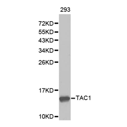 Western blot - TAC1 antibody from Signalway Antibody (38276) - Antibodies.com
