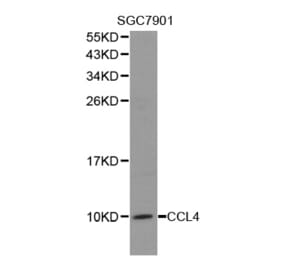 Western blot - CCL4 antibody from Signalway Antibody (38278) - Antibodies.com