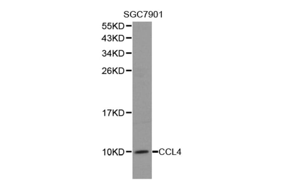 Western blot - CCL4 antibody from Signalway Antibody (38278) - Antibodies.com