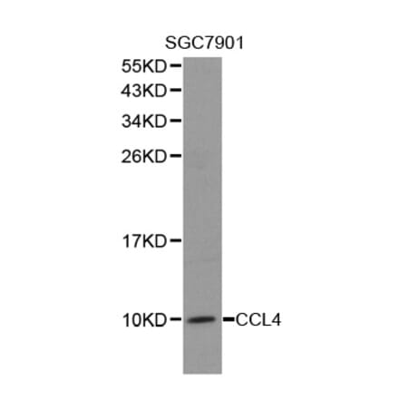 Western blot - CCL4 antibody from Signalway Antibody (38278) - Antibodies.com