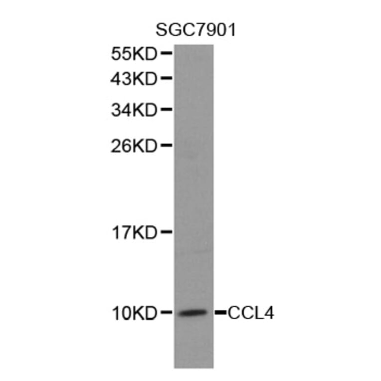Western blot - CCL4 antibody from Signalway Antibody (38278) - Antibodies.com