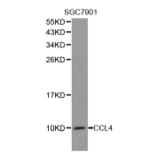 Western blot - CCL4 antibody from Signalway Antibody (38278) - Antibodies.com