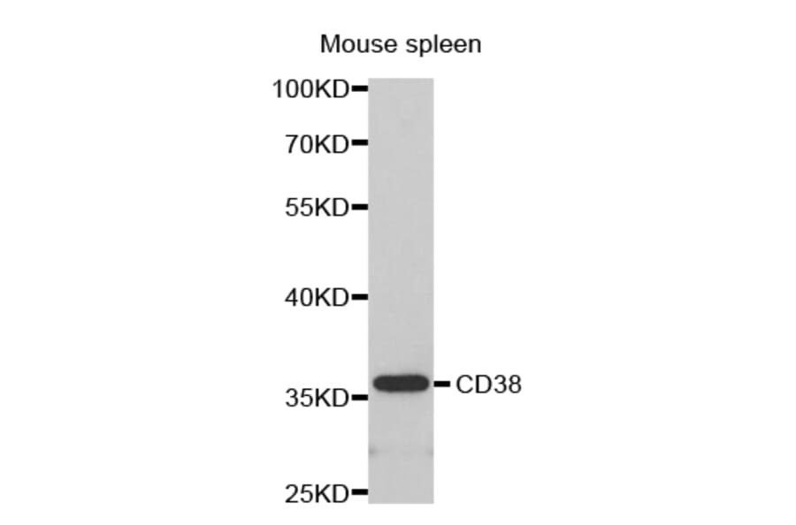 Western blot - CD38 antibody from Signalway Antibody (38280) - Antibodies.com