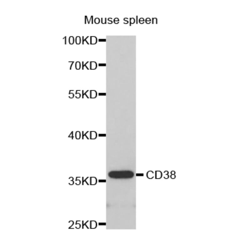 Western blot - CD38 antibody from Signalway Antibody (38280) - Antibodies.com