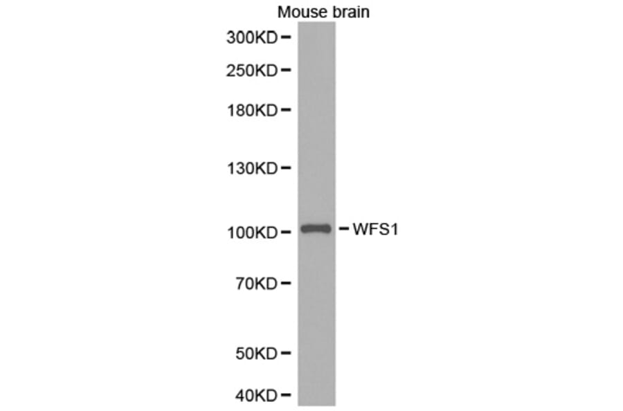 Western blot - WFS1 antibody from Signalway Antibody (38285) - Antibodies.com