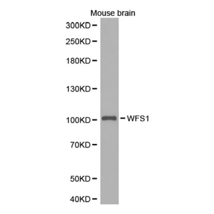 Western blot - WFS1 antibody from Signalway Antibody (38285) - Antibodies.com