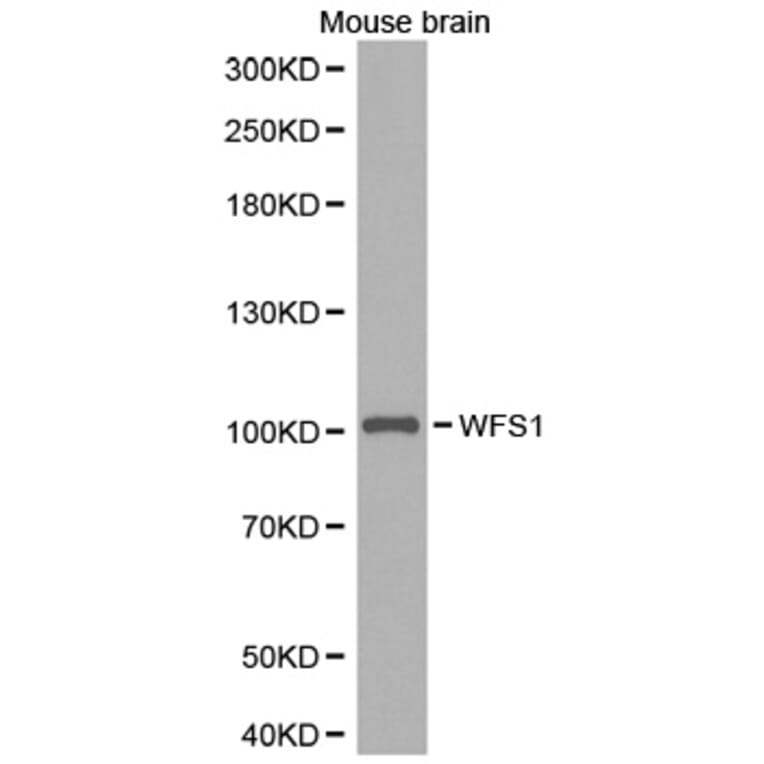 Western blot - WFS1 antibody from Signalway Antibody (38285) - Antibodies.com