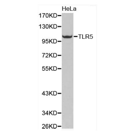 Western blot - TLR5 antibody from Signalway Antibody (38286) - Antibodies.com