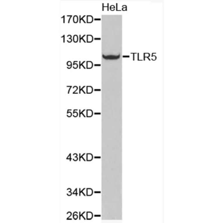 Western blot - TLR5 antibody from Signalway Antibody (38286) - Antibodies.com