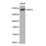 Western blot - MED1 antibody from Signalway Antibody (38289) - Antibodies.com
