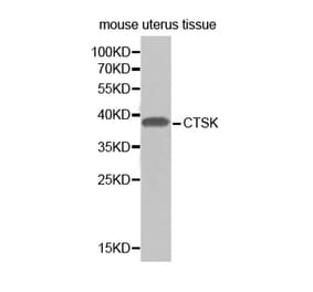 Western blot - CTSK antibody from Signalway Antibody (38297) - Antibodies.com