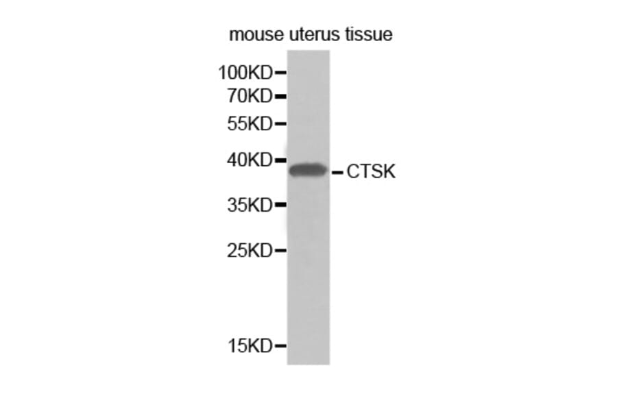 Western blot - CTSK antibody from Signalway Antibody (38297) - Antibodies.com