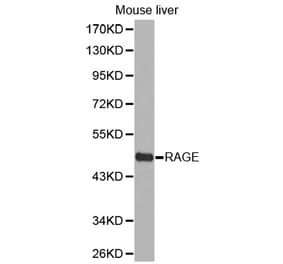 Western blot - RAGE antibody from Signalway Antibody (38298) - Antibodies.com