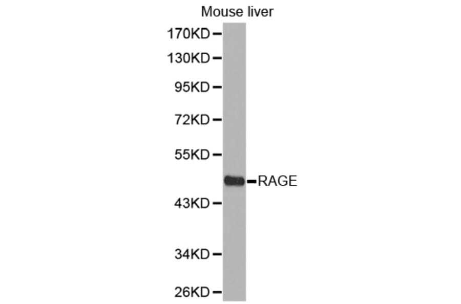 Western blot - RAGE antibody from Signalway Antibody (38298) - Antibodies.com