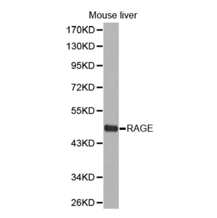 Western blot - RAGE antibody from Signalway Antibody (38298) - Antibodies.com