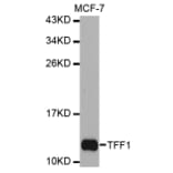 Western blot - TFF1 antibody from Signalway Antibody (38299) - Antibodies.com