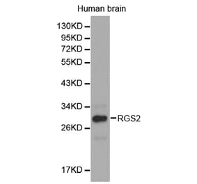Western blot - RGS2 antibody from Signalway Antibody (38301) - Antibodies.com