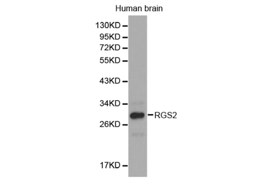 Western blot - RGS2 antibody from Signalway Antibody (38301) - Antibodies.com