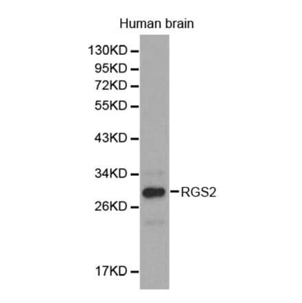 Western blot - RGS2 antibody from Signalway Antibody (38301) - Antibodies.com