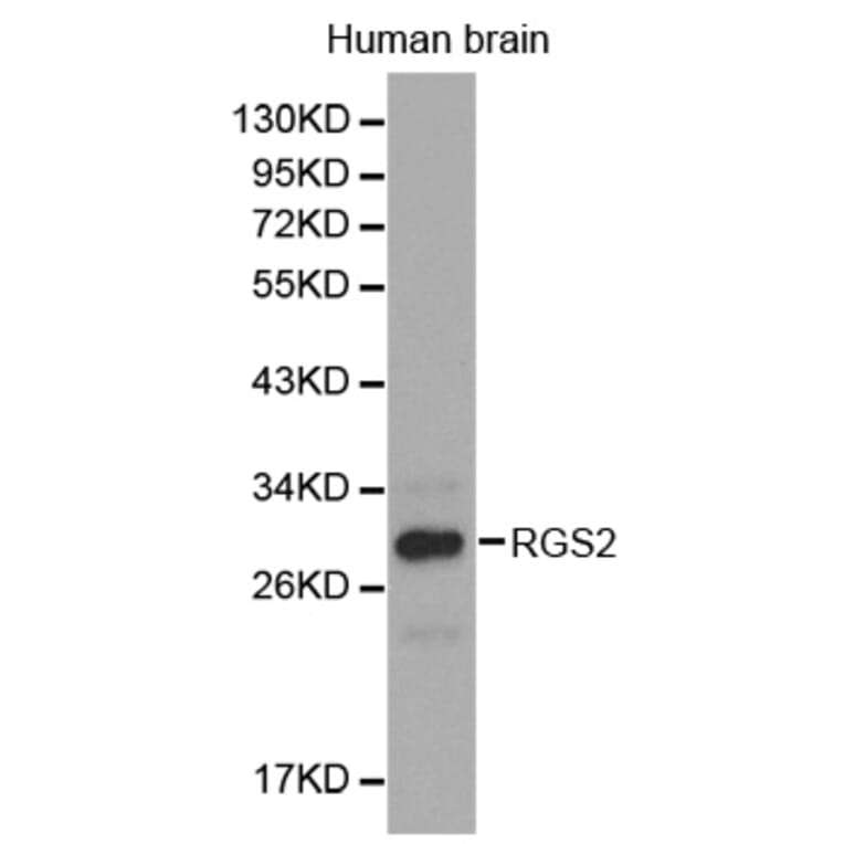 Western blot - RGS2 antibody from Signalway Antibody (38301) - Antibodies.com