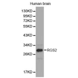 Western blot - RGS2 antibody from Signalway Antibody (38301) - Antibodies.com