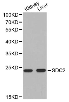 Western blot analysis of extracts of various cell lines, using SDC2 antibody.