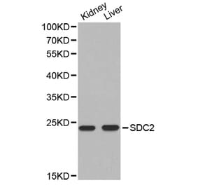 Western blot - SDC2 antibody from Signalway Antibody (38303) - Antibodies.com