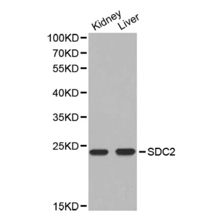 Western blot - SDC2 antibody from Signalway Antibody (38303) - Antibodies.com