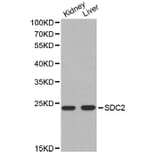 Western blot - SDC2 antibody from Signalway Antibody (38303) - Antibodies.com